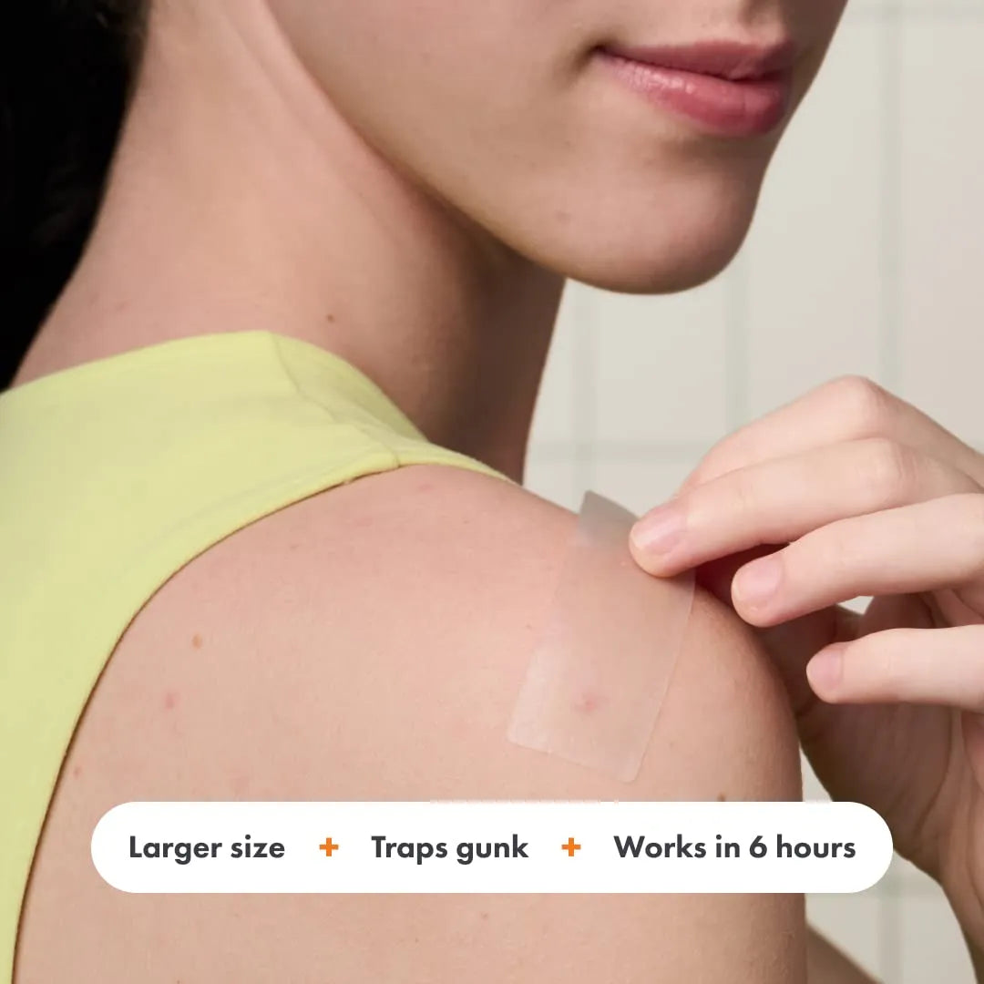 Mighty Patch Surface Large Pimple Patches for Face