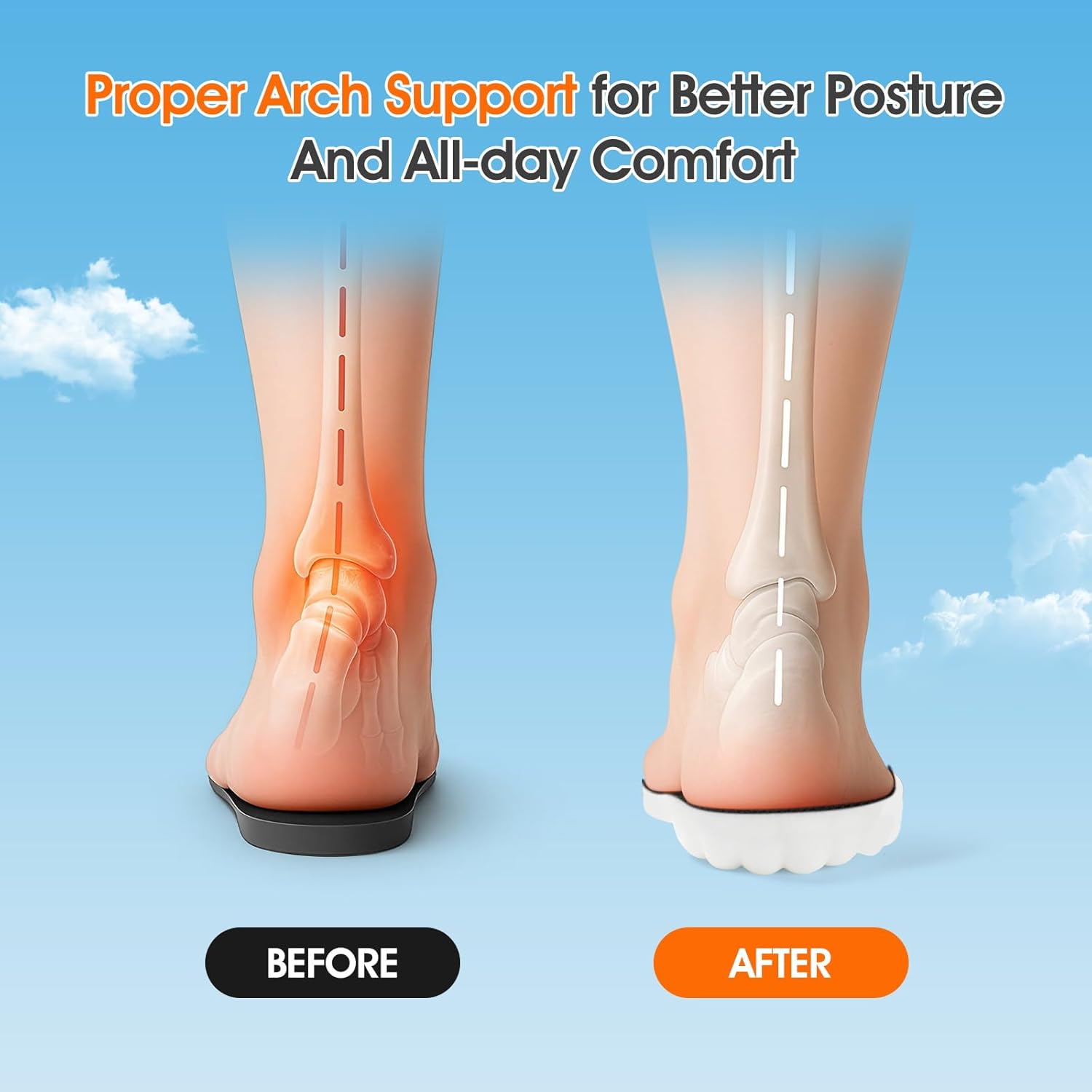 4D Cloud-Like Comfort Soles