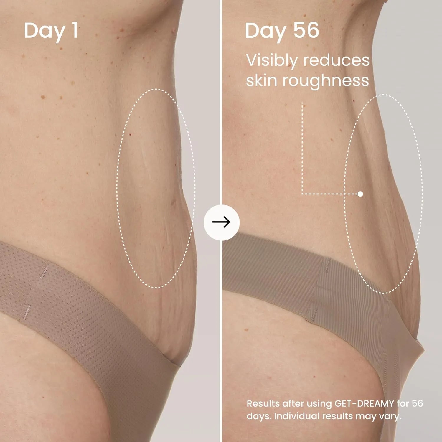 MAËLYS GET-DREAMY Overnight Toning Whip