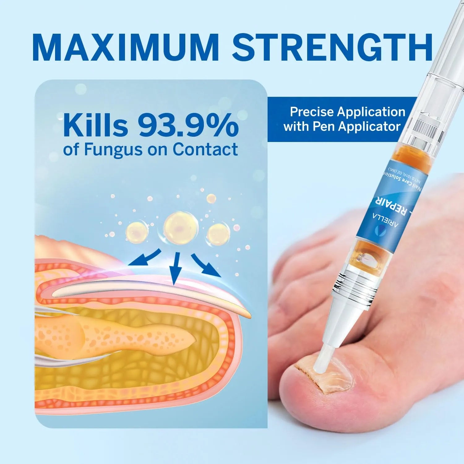 Nail Fungus Treatment for Toenail