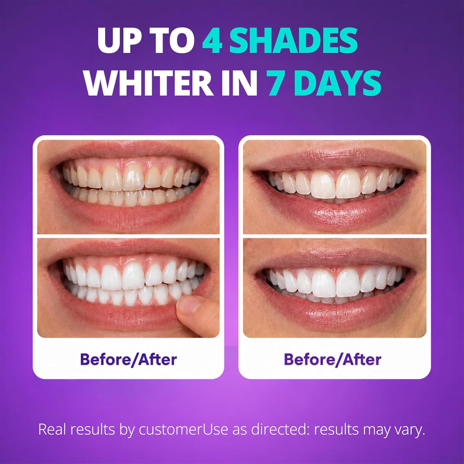 SAKYPRORAL Purple Whitening Strips
