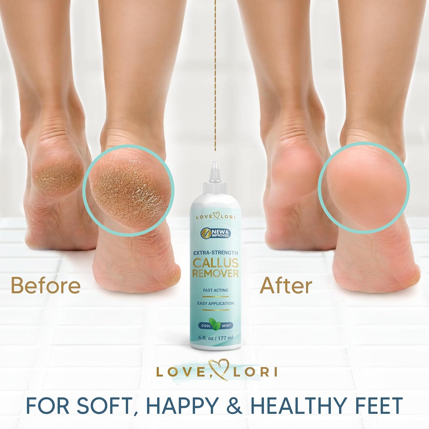 Callus Remover for Feet