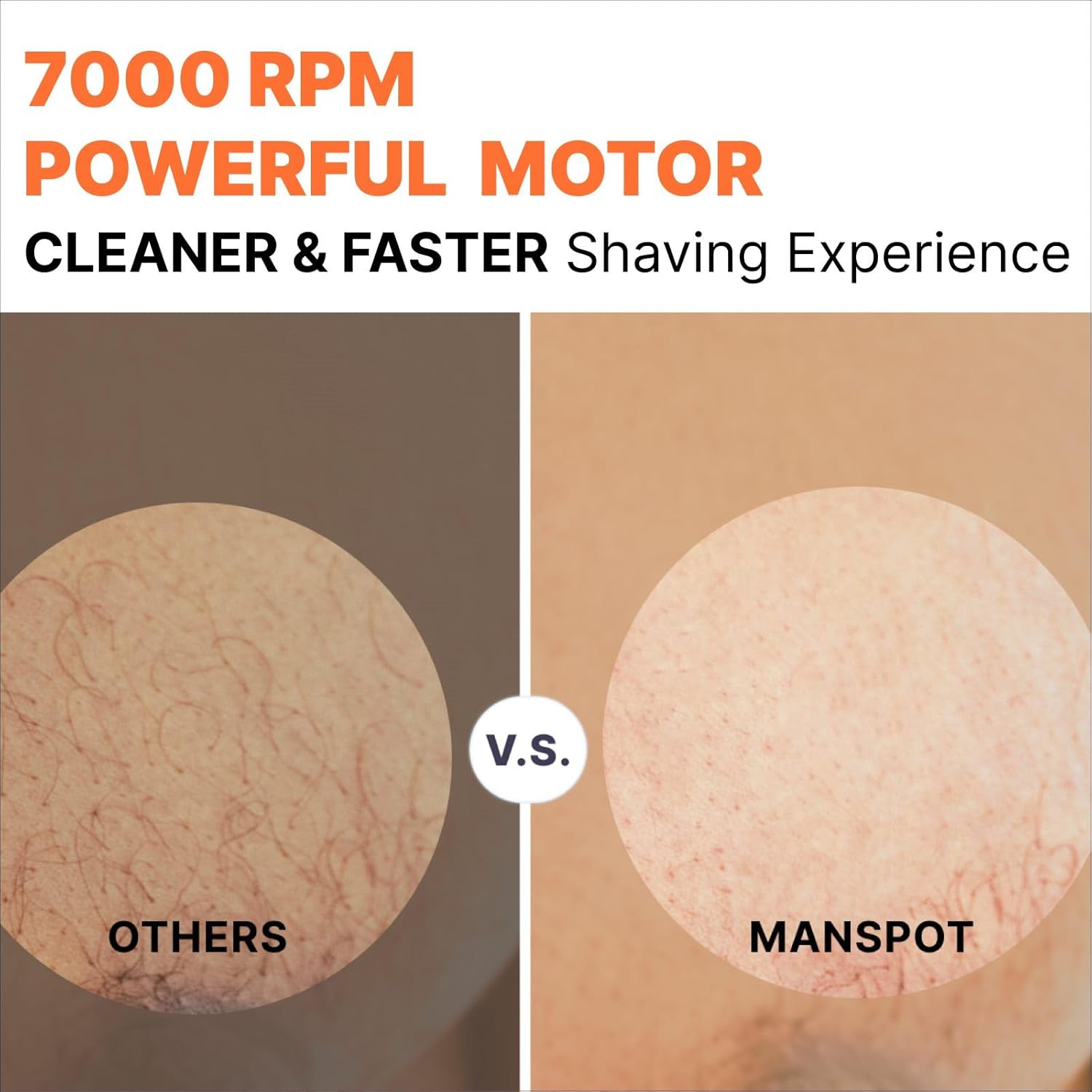 MANSPOT Manscape Groin & Body Hair Trimmer for Men