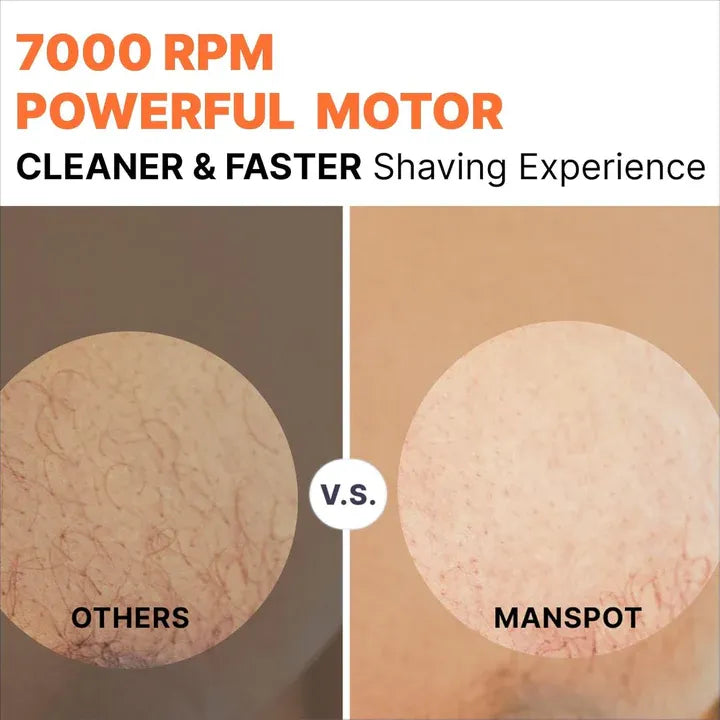 MANSPOT Manscape Groin & Body Hair Trimmer for Men