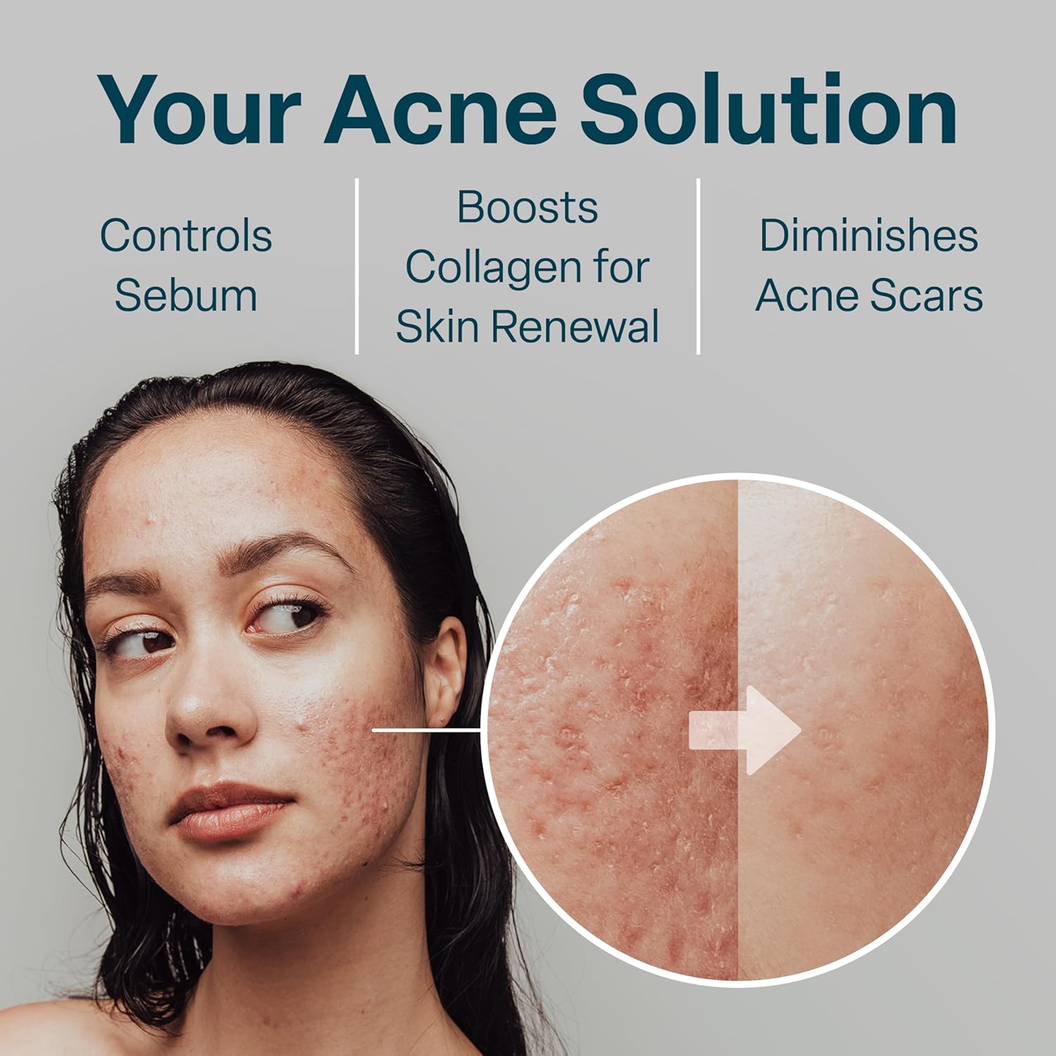 QRxLabs Salicylic & Glycolic Acid Pads