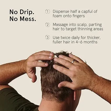 Keeps Extra Strength Minoxidil