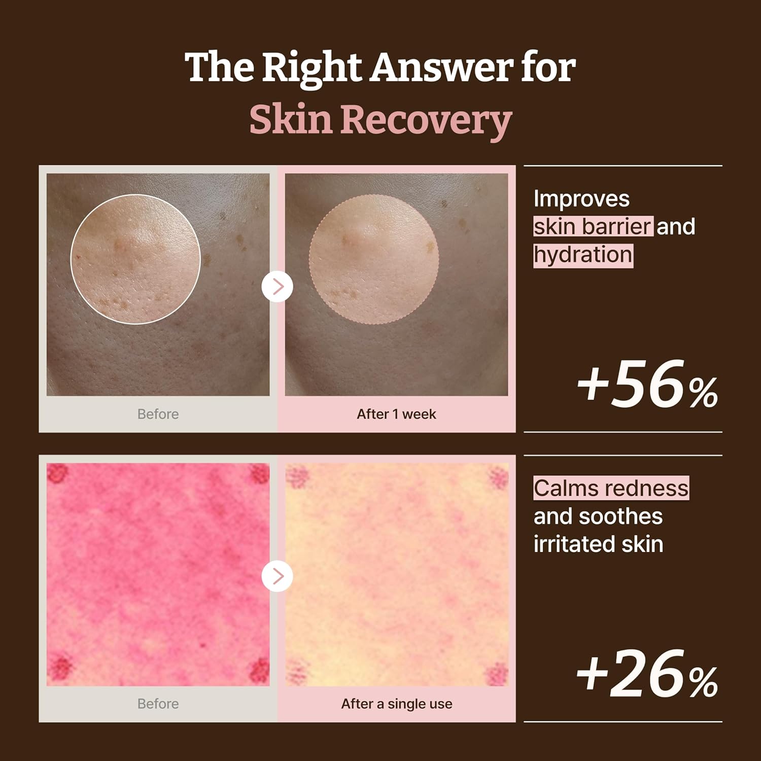 Dr.Reju-All PDRN Rejuvenating Cream