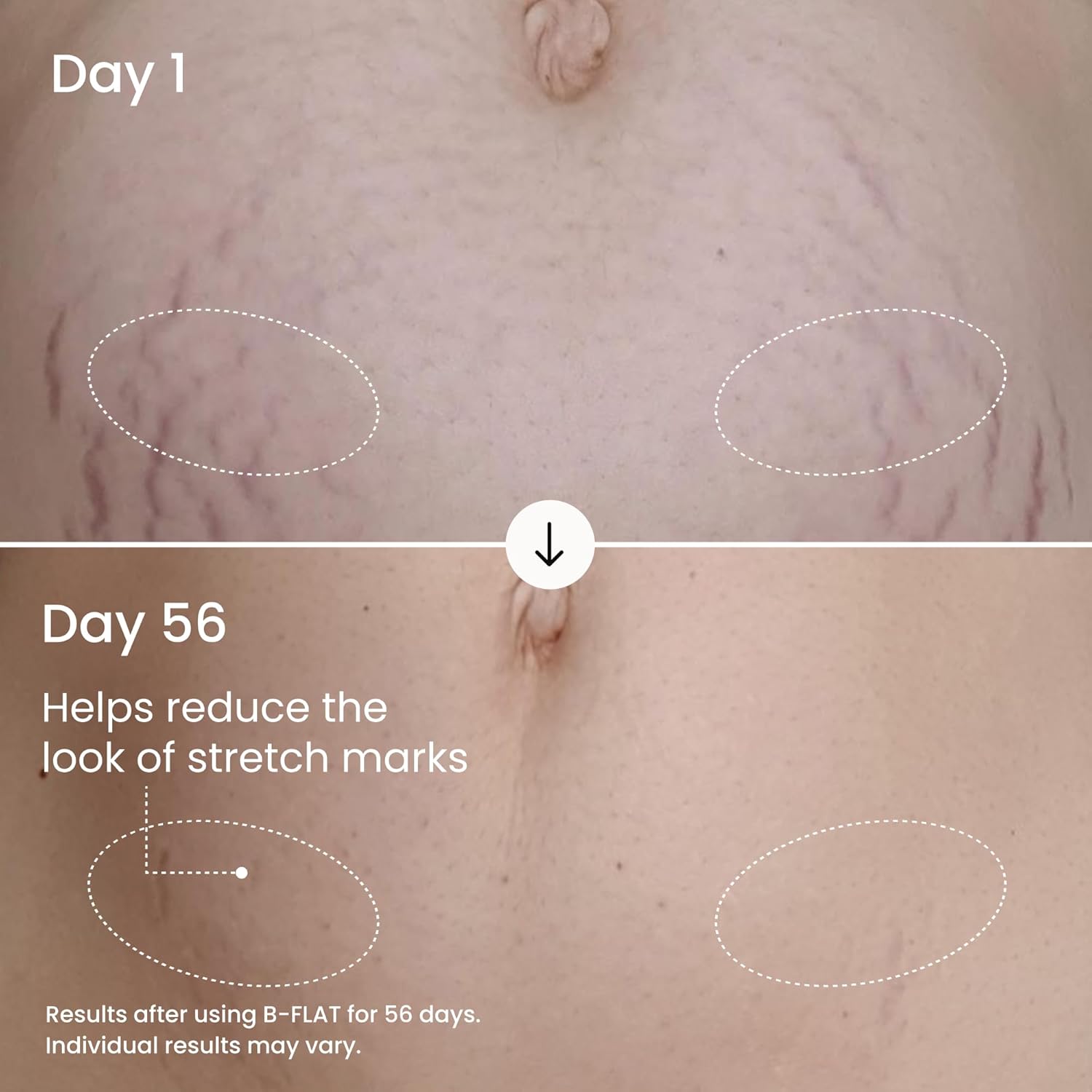 MA‚àö√£LYS B-FLAT Belly Firming Cream for Women