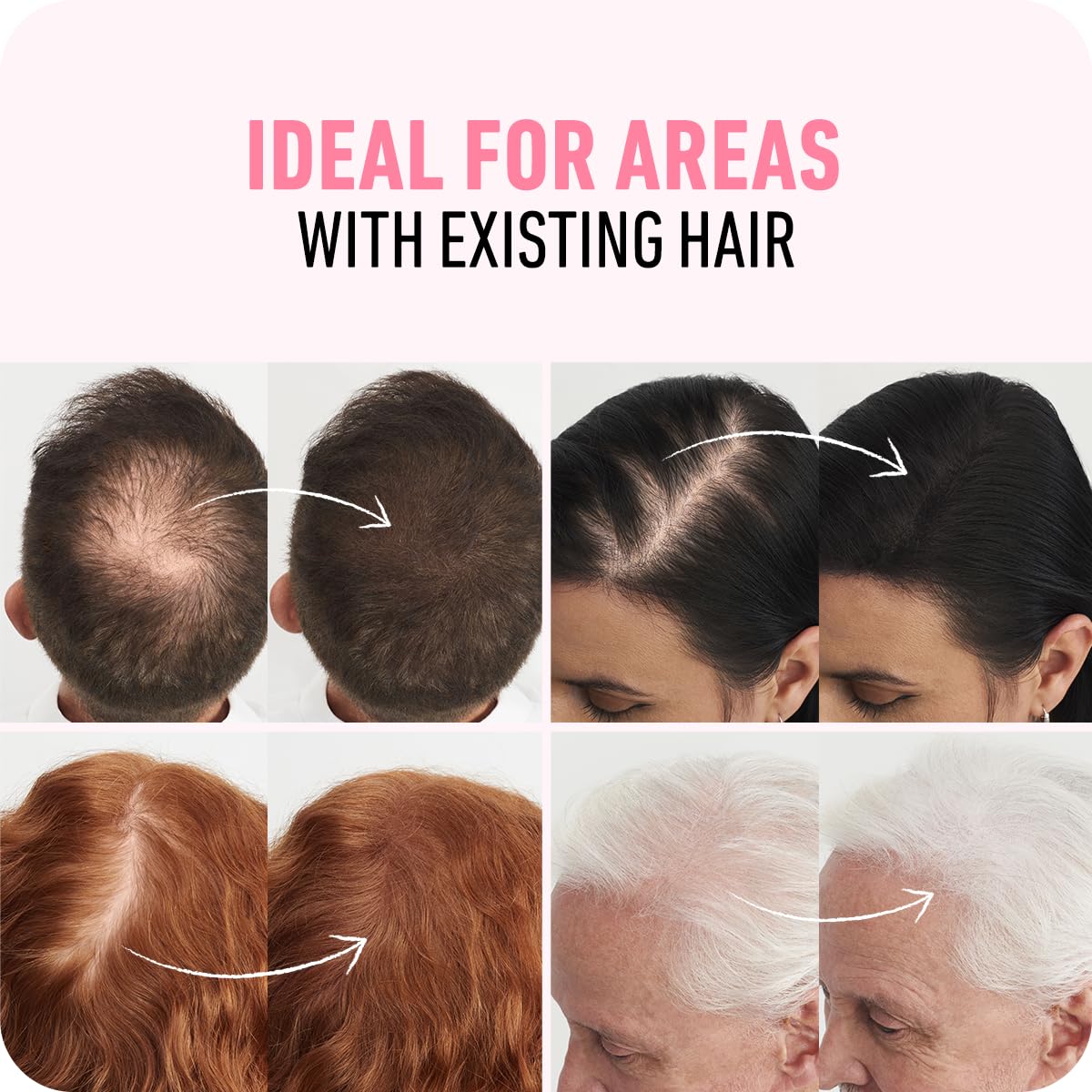 BOLDIFY Hair Fibers (56g) - Fill In Thinning and Fine Hair for an Instantly Fuller Thicker Look - 14 Shades for Women & Men - Hazel Brown