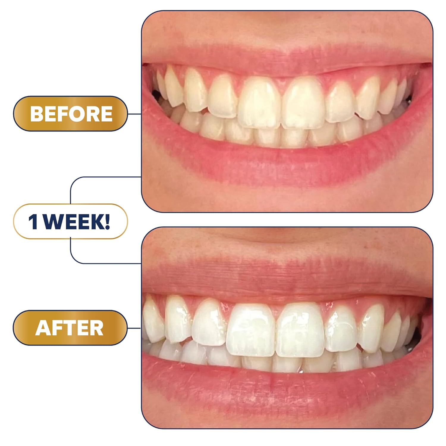 Lumineux Teeth Whitening Strips