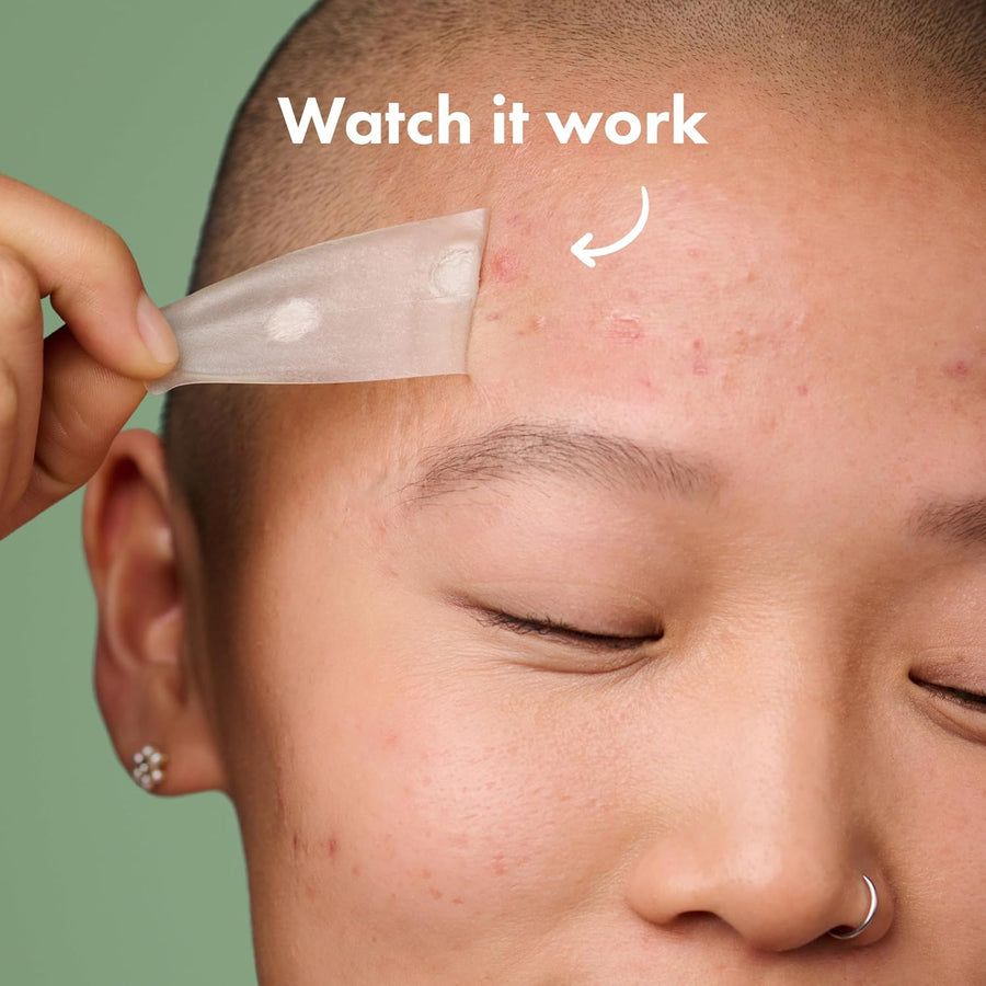 Mighty Patch Surface Large Pimple Patches for Face from Hero Cosmetics, Acne Spot for Body, Cheek, Forehead, and Chin, Pimple Stickers, Hydrocolloid Covers, Vegan-friendly, 10 Count