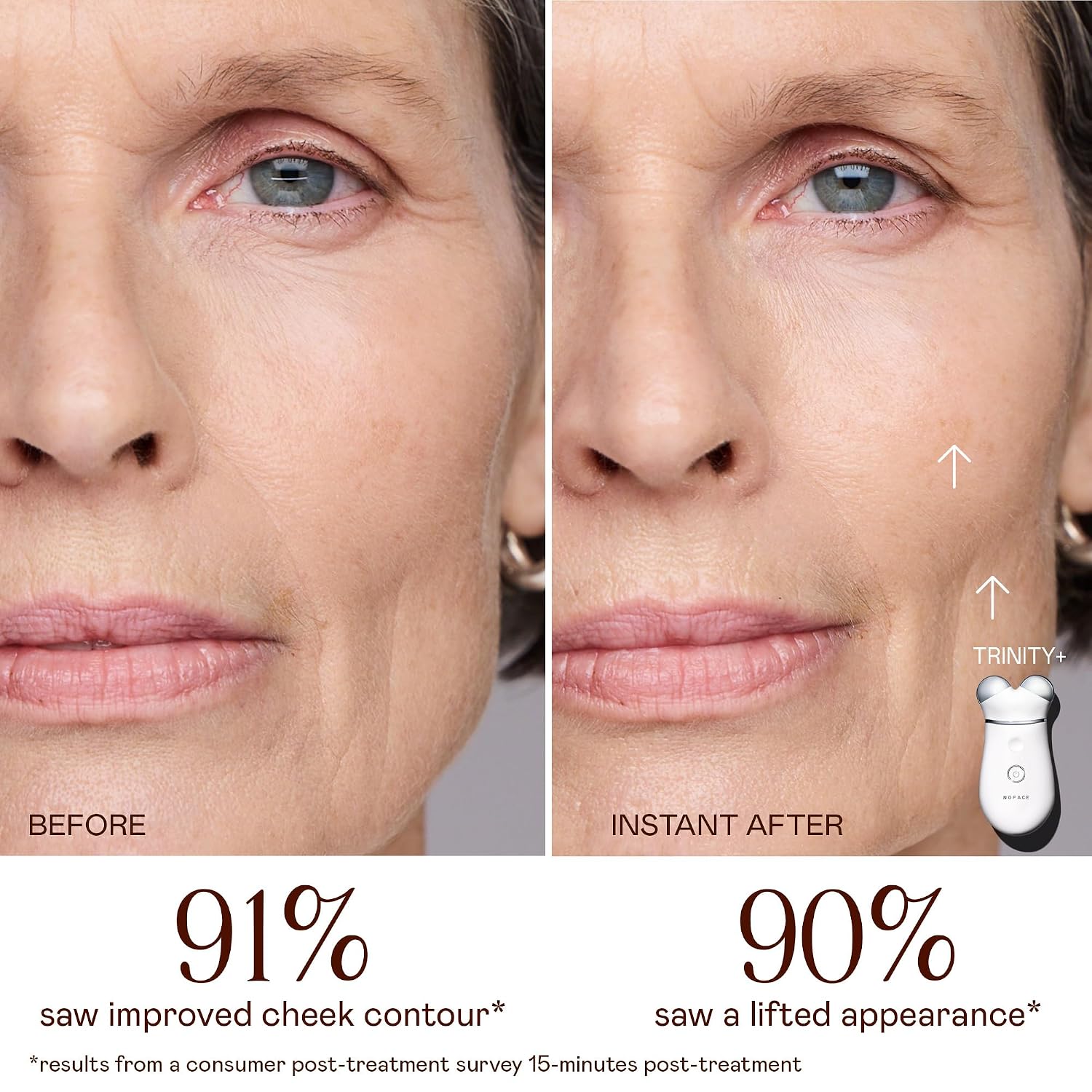NUFACE TRINITY+ Facial Sculpting Device with Lip & Eye Attachment