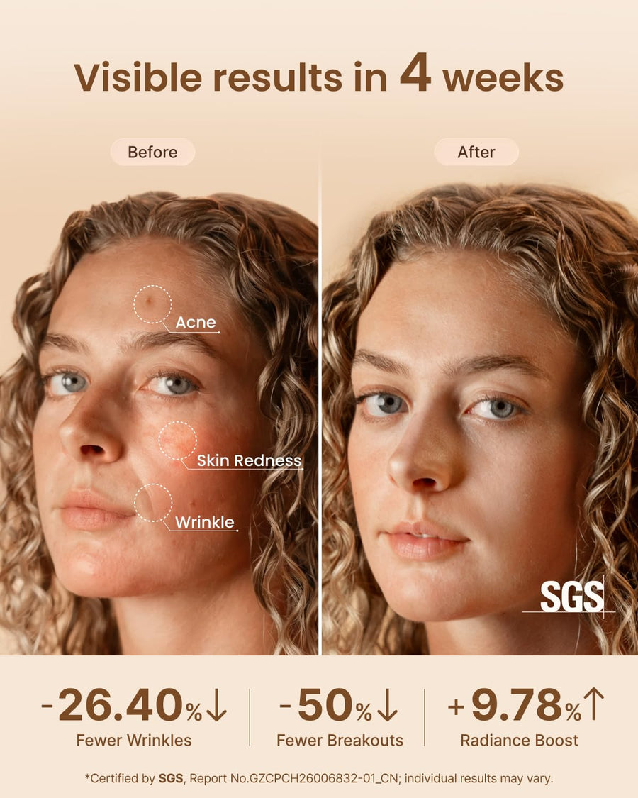 RENPHO 4D Red Light Therapy Mask