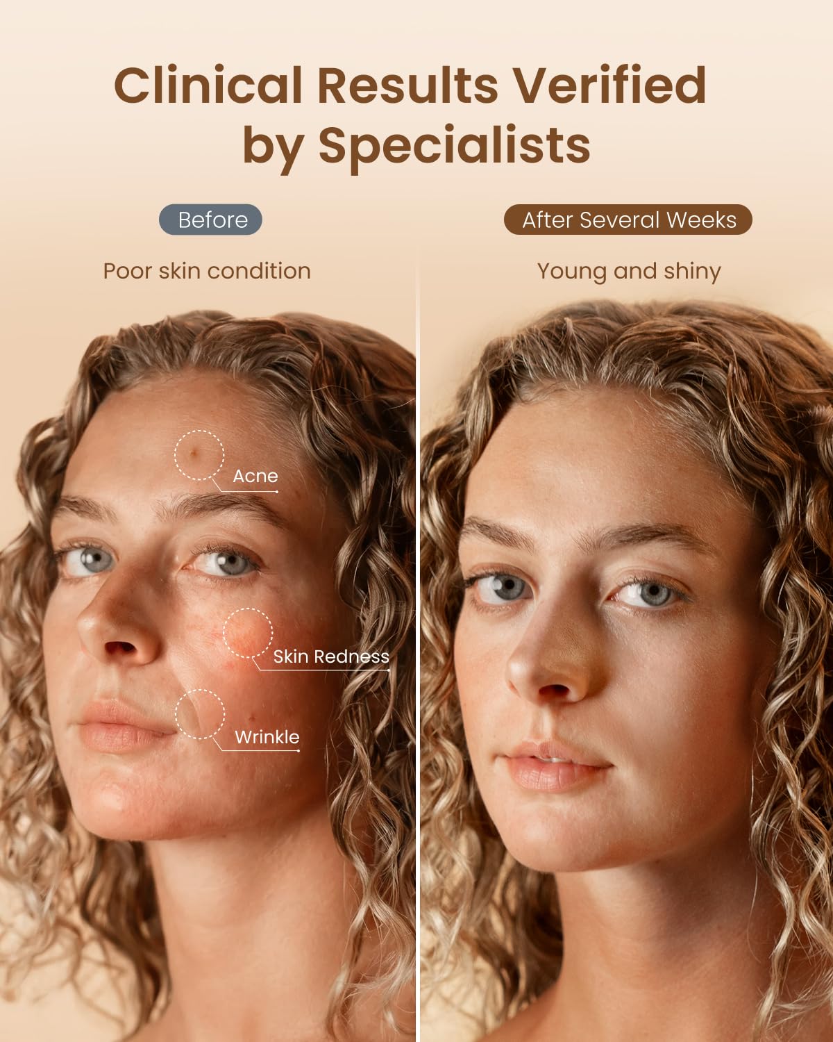 RENPHO 4D Red Light Therapy Mask