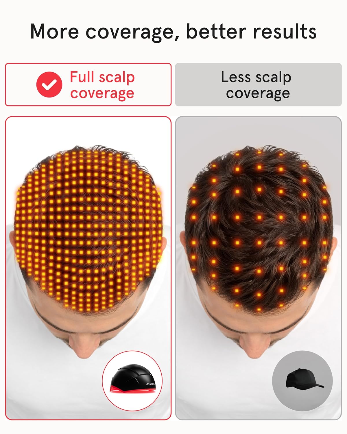 iRestore Elite + Rechargeable Battery Pack - Laser Red Light Therapy for Hair Growth - FDA Cleared Hair Loss, Hair Thinning Treatment for Men & Women - Hair Regrowth Laser Cap - 500 Lasers & LEDs