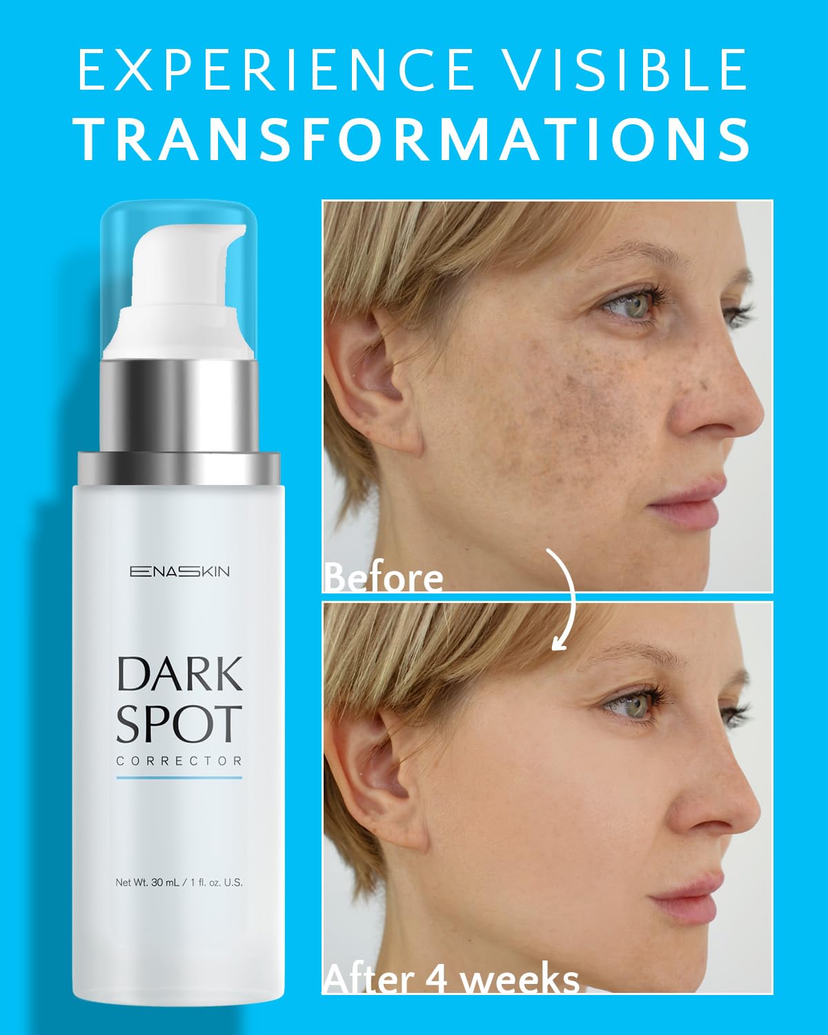 EnaSkin Dark Spot Remover for Face and Body: Advanced Formula Spot Corrector Cream to Fade Age Spots, Sun Spots, Freckles, Melasma, and Brown Spots for Women and Men (1.7 Oz)