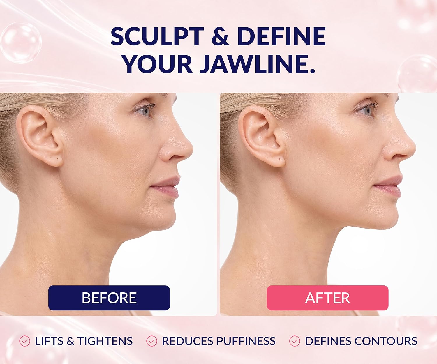 Stylia V Line Lifting Collagen Mask - Lift Firm & Contour Jawline - Tightening Double Chin Strap with Hyaluronic Acid & Aloe - Neck Tightening and Lifting Mask - Jawline Shaper Face Lift Tape (10PC)