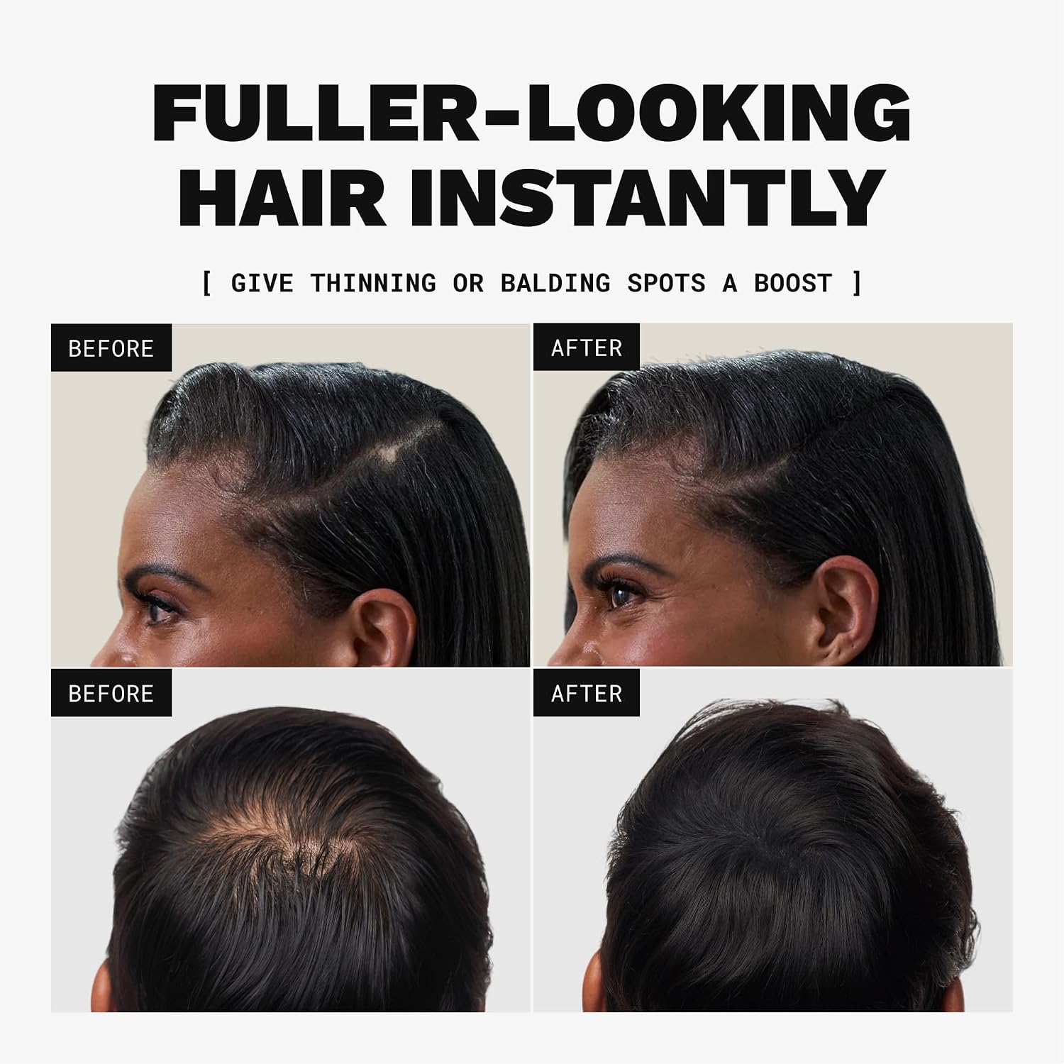 Toppik Hair Building Fibers, Fill In Fine or Thinning Hair Instantly Thicker, Fuller Looking Hair 9 Shades,4 size options, Auburn, Medium 12g